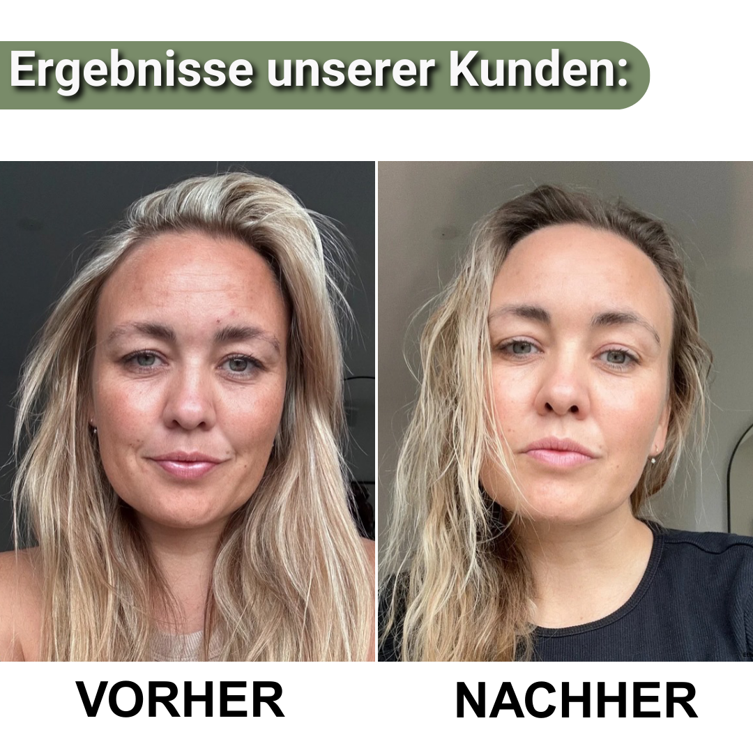 LioraGlanz Reis Peeling – Das perfekte Haut-Set für sichtbar glattere, strahlendere Haut