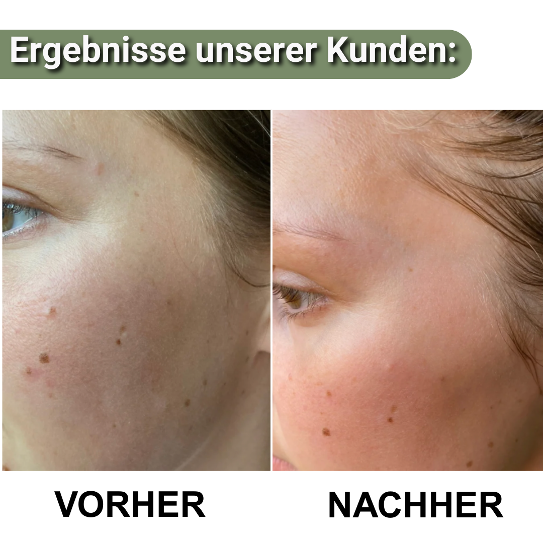 LioraGlanz Reis Peeling – Das perfekte Haut-Set für sichtbar glattere, strahlendere Haut
